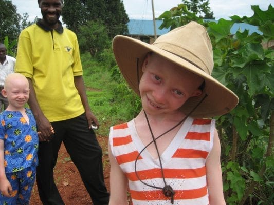 Humanity Healing International Albino Rescue